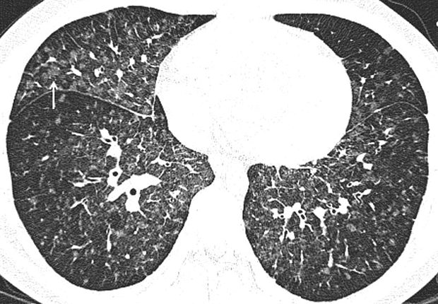 postgradmedj-2012-July-88-1041-397-F16.large postgradmedj-2012-July-88-1041-397-F16.large